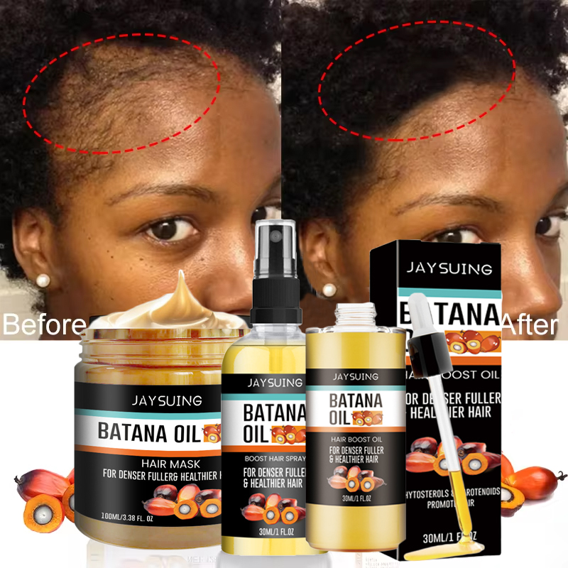 高速育毛セット Batana オイルトラクション脱毛症ヘアマスクアンチブレイク損失育毛オイルハゲ治療ヘアヘルスケア