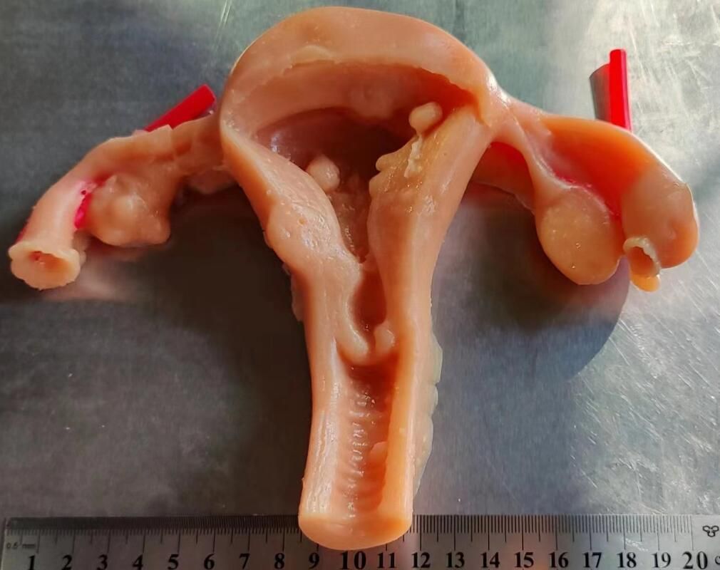 婦人科腹腔鏡下剪断縫合糸ストリッピング運動用 3D 生体模倣モジュール模擬子宮シリコンモデル
