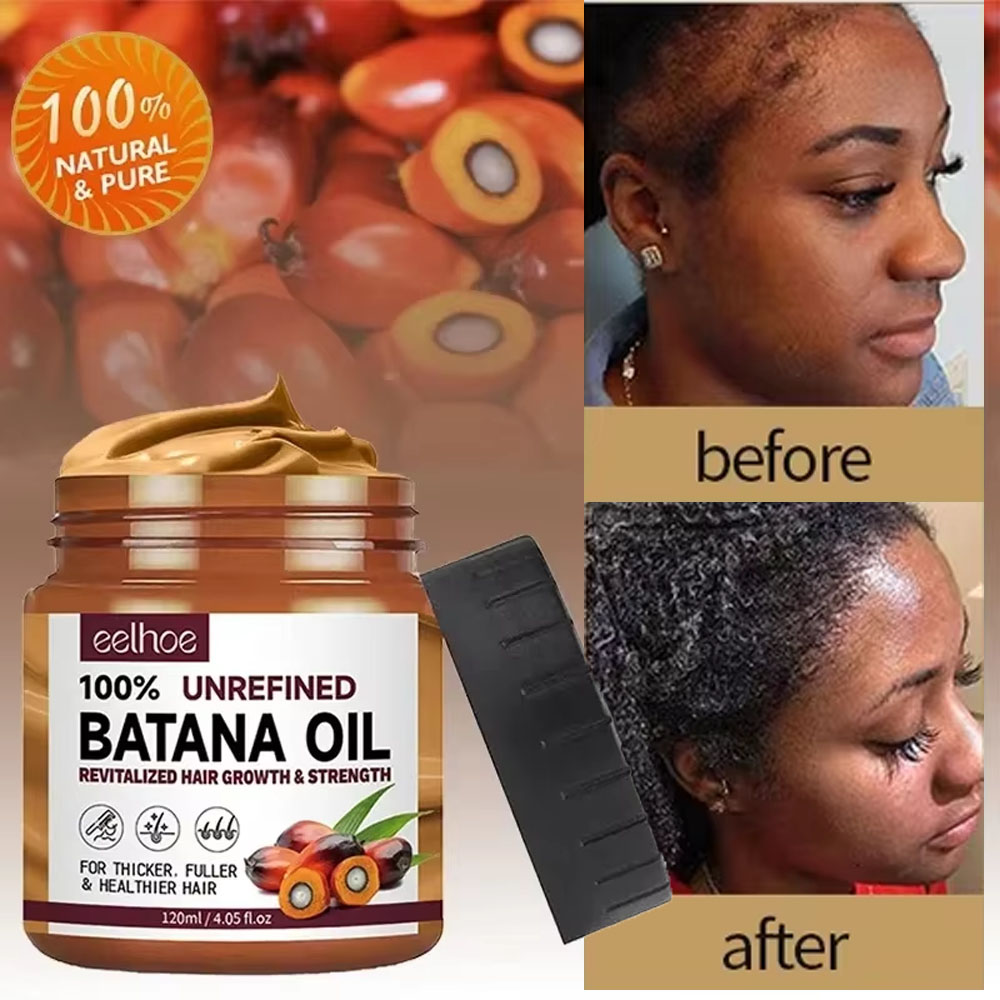 Batana 育毛オイルコンディショナー抗脱毛製品高速成長ヘアマスク栄養修復根ヘアケア女性のための