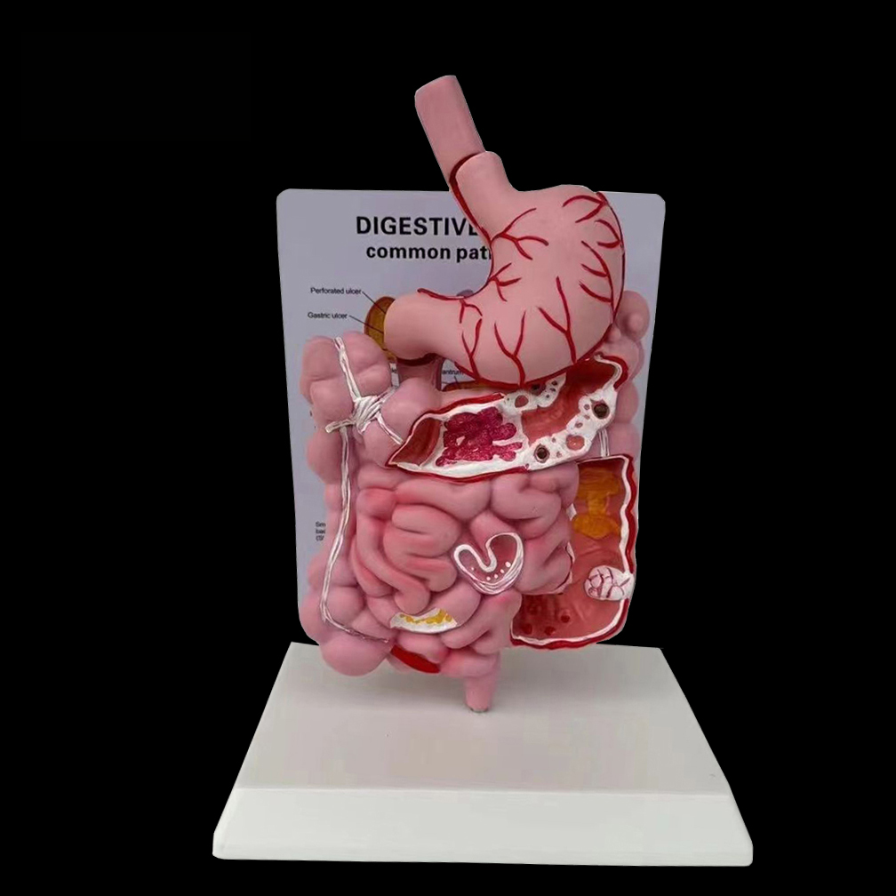 ヒト消化器系モデル 胃の解剖図 大腸盲腸 直腸 十二指腸 ヒト内臓構造モデル