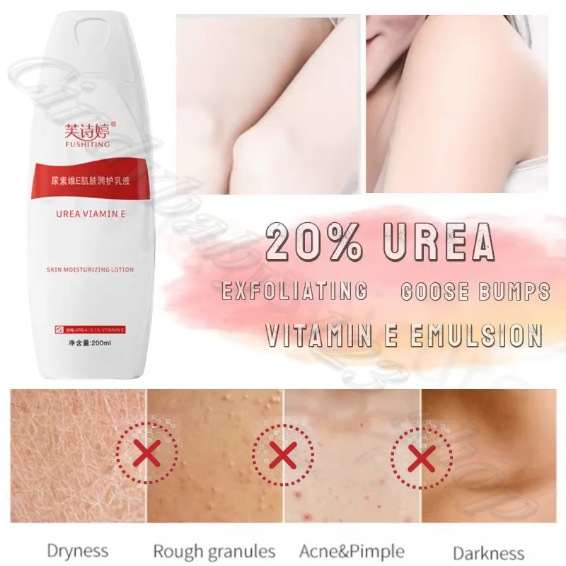20% 尿素ビタミン E ボディローションは効果的に吸収し、荒れた鶏の肌を改善し、水分補給と保湿をします 200 ml
