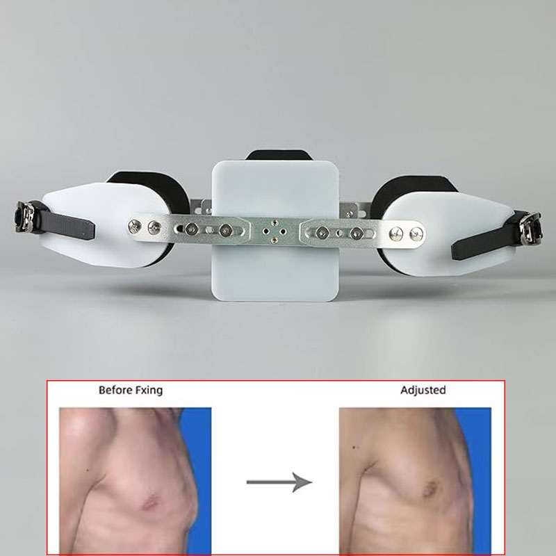調整可能な胸郭装具ブレースピジョン胸部装具サポート肋骨外反装具ブレース子供大人ユニバーサル