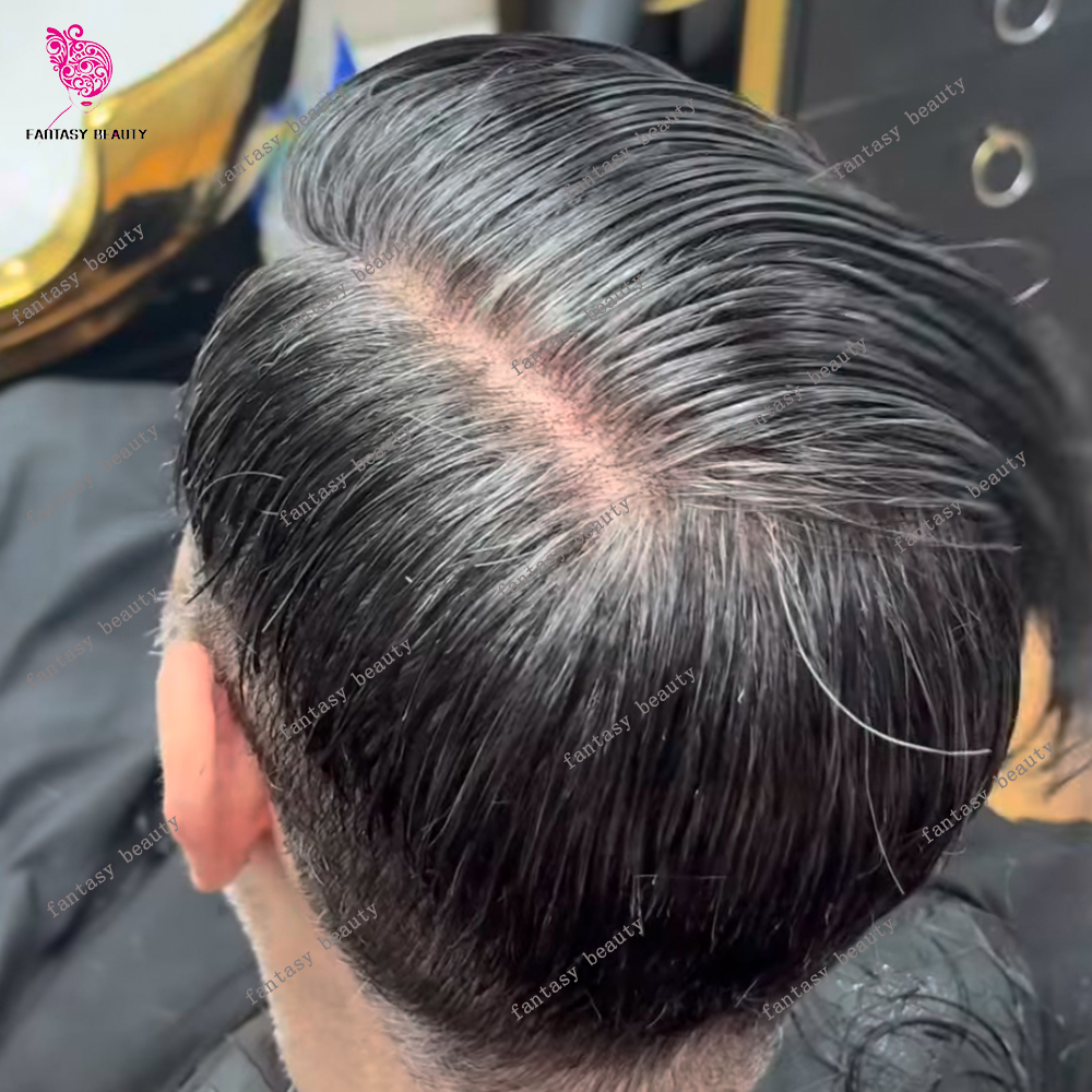 強い皮膚ベース人毛男性のかつらハゲ毛置換システムスカラップナチュラルヘアラインブラックブラウン