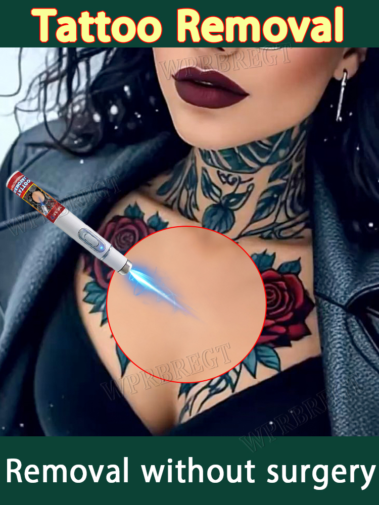 Blue light tattoo removal pen, unisex, ˢᵘⁱᵗᵃᵇˡᵉ ᶠᵒʳ ᵃˡˡ ᵃᵍᵉˢ, promotional discount, free shipping.