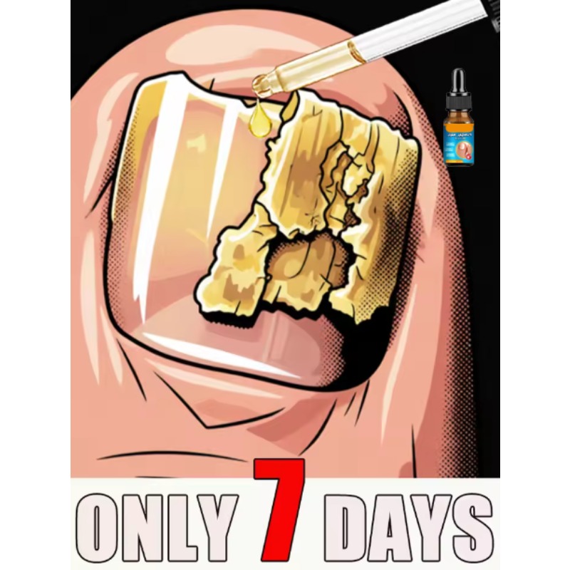 ᴹⁱˡᵈ ᵃⁿᵗⁱᵇᵃᶜᵗᵉʳⁱᵃˡ ⁿᵃⁱˡ ᵖʳᵒᵗᵉᶜᵗⁱᵒⁿ ᵗᵒ prevent nail deformation and falling off