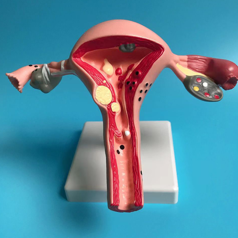 新しいヒト病理学の子宮卵巣モデル断面構造モデル子宮解剖学女性器教育学習ツール