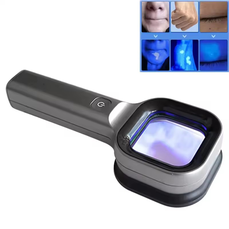 ウッズランプ スキンアナライザー 皮膚 UV 拡大鏡 皮膚テスト 家庭用 顔テスト ウッドライト 顔分析検出 ビューティーケア