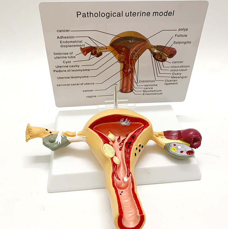 人体モデル女性生殖器子宮膣卵​​巣子宮教育用カビ病理学一般科学トレーニング教育ツール