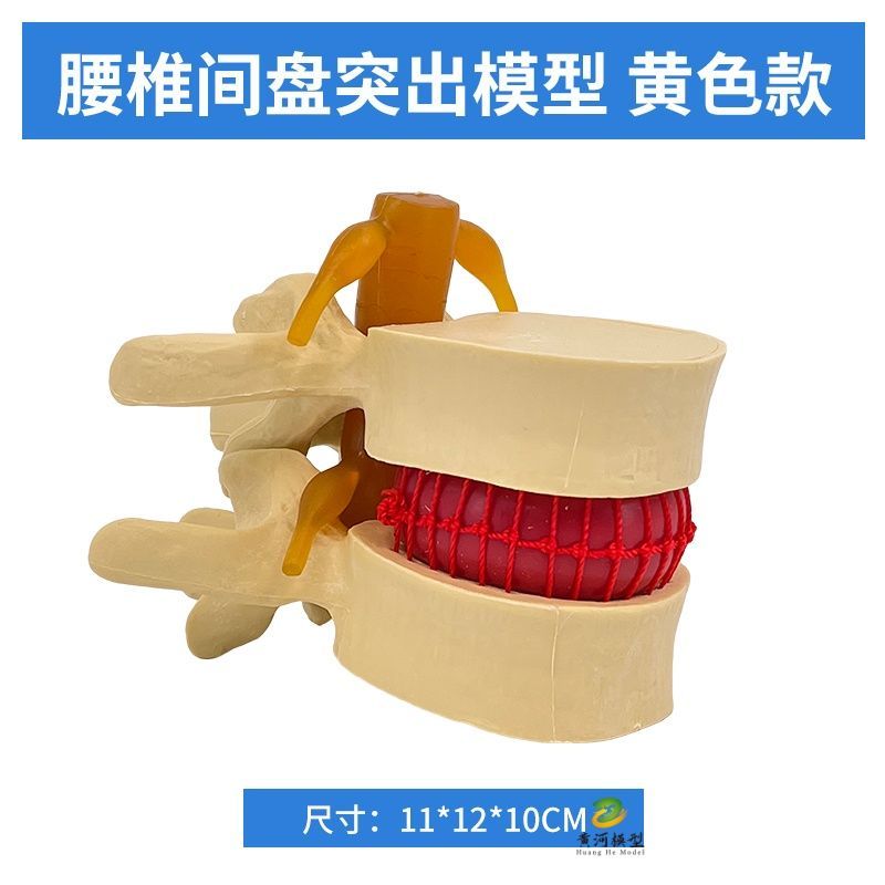 人体脊椎模型、脊椎骨、腰椎椎間板模型、椎間板ヘルニア、圧迫病理、骨教育補助教材