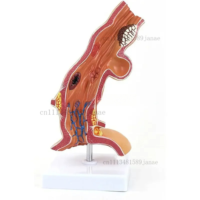 2026 New Human Anatomical Department Of Esophagus And Digestive Model For Medical Educational