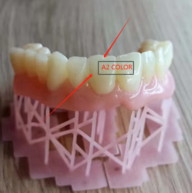 レジン歯科 仮歯用 TEMPORARY CROWN 3D 印刷 A2 A1color 高靱性強度 UV 感光性 光硬化