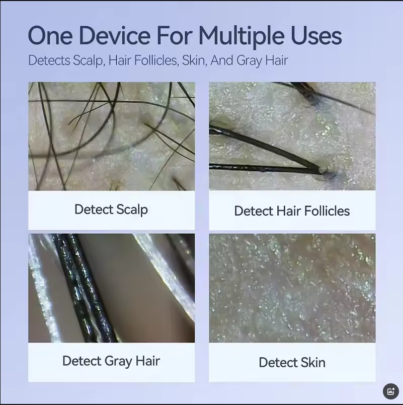 ポータブル頭皮カメラ美容機器スキンアナライザーUSB頭皮診断装置毛穴拡大鏡電話タブレット使用