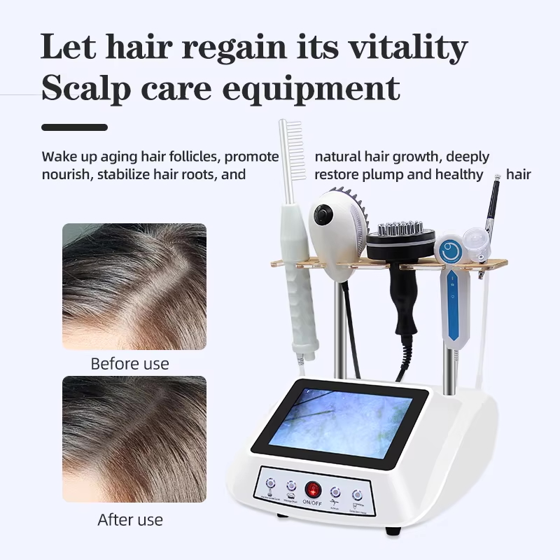プロフェッショナル頭皮検出 5 in 1 頭皮ヘアケアアナライザーマシンヘッドマッサージ皮膚分析装置 200X HD レンズ付き