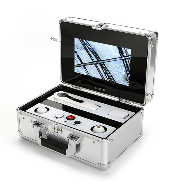 サロン肌診断アナライザー毛包頭皮検出器SA-S20毛髪アナライザー