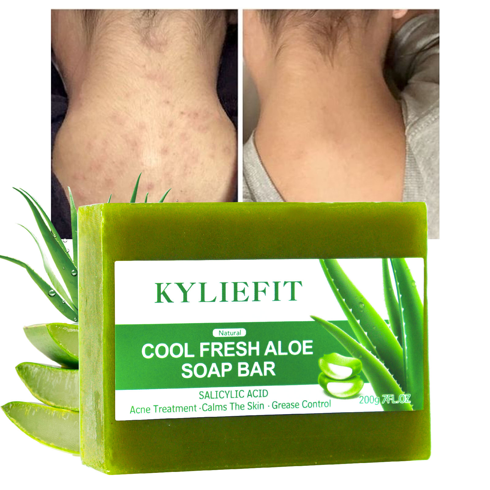 KYLIEFIT クールフレッシュナチュラルアロエベラソープバー、すべての肌タイプ用、美白、シミ、ニキビを軽減、滑らかな肌、200g