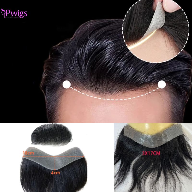 Pwigs Men V 前頭ヘアライン 1B