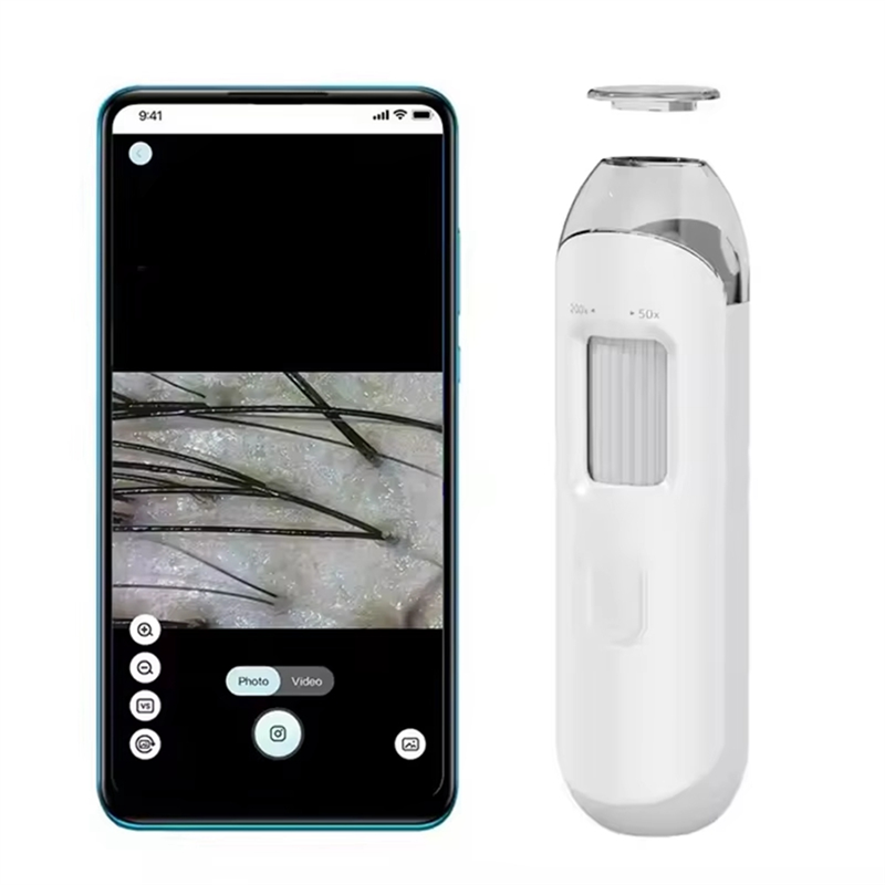 プロフェッショナル皮膚健康アナライザー電子皮膚鏡 - デジタル頭皮カメラと毛穴拡大ツール