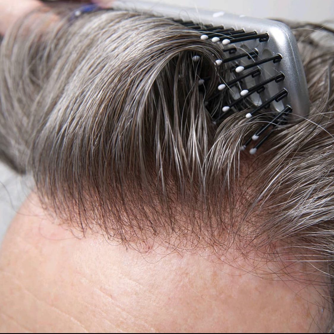 マイクロスキン メンズウィッグ ナチュラルヘアライン