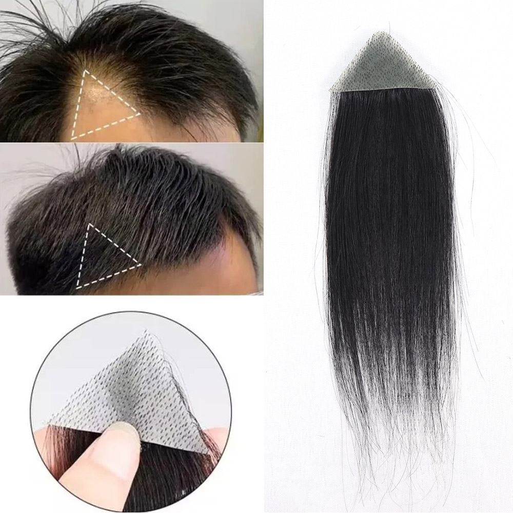 小額かつらかつら人毛前頭レミーヘアパッチ男性 0.06 ミリメートル超薄皮男性の毛細血管プロテーゼ